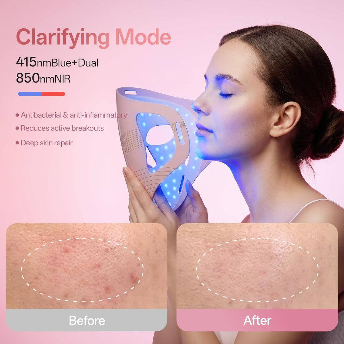 LED Light Therapy Face Mask - Red, Blue & Infrared | Anti-Aging & Acne Treatment - Gloss & Grit