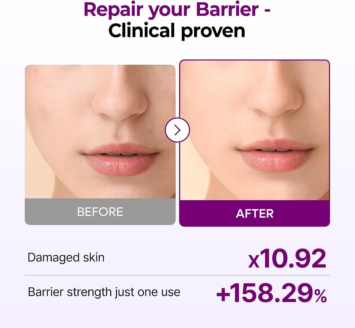 Calcium Bonding Barrier Facial Toner