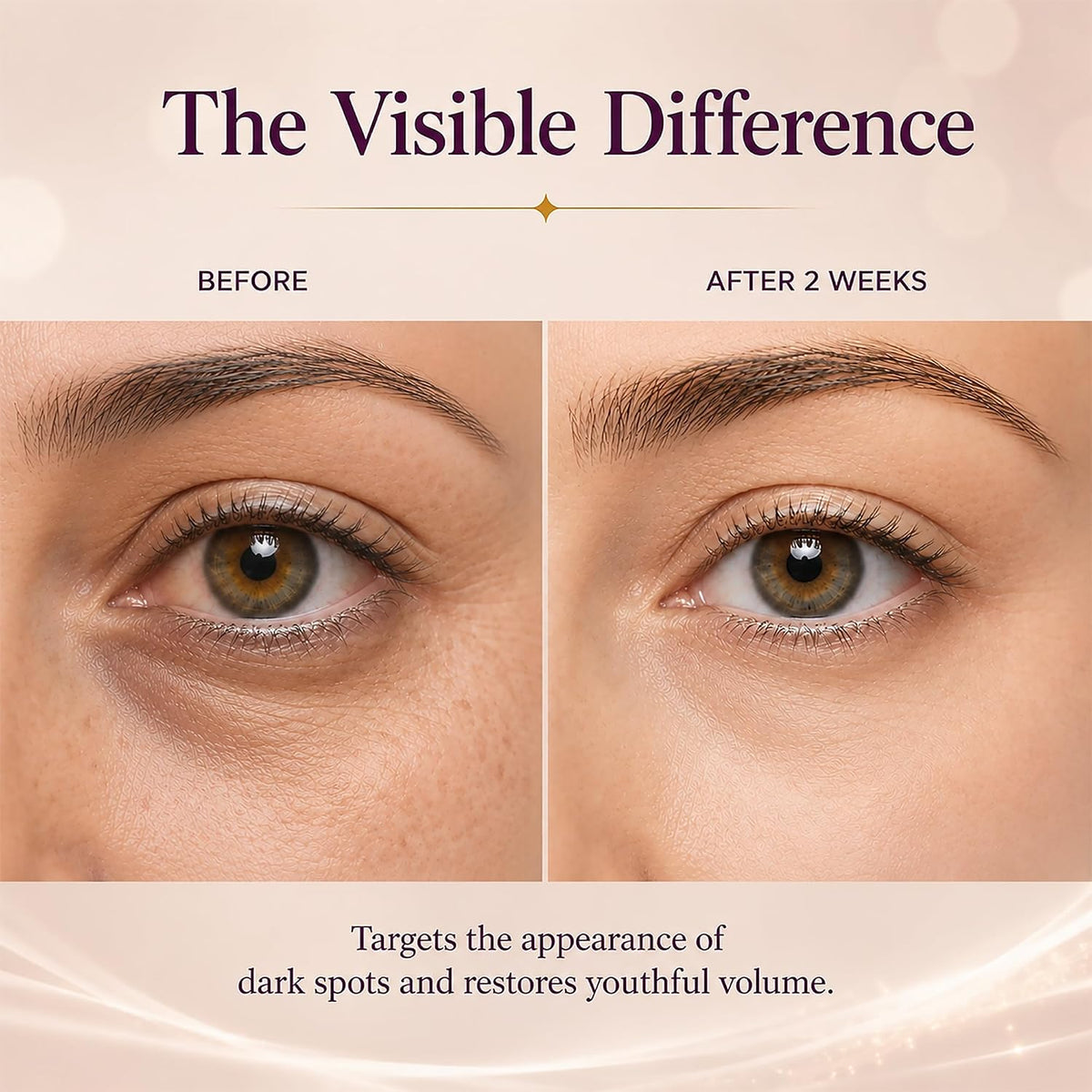 LRUSEIFE Calcium Dark Spot Eye Cream before-and-after eye-area graphic
