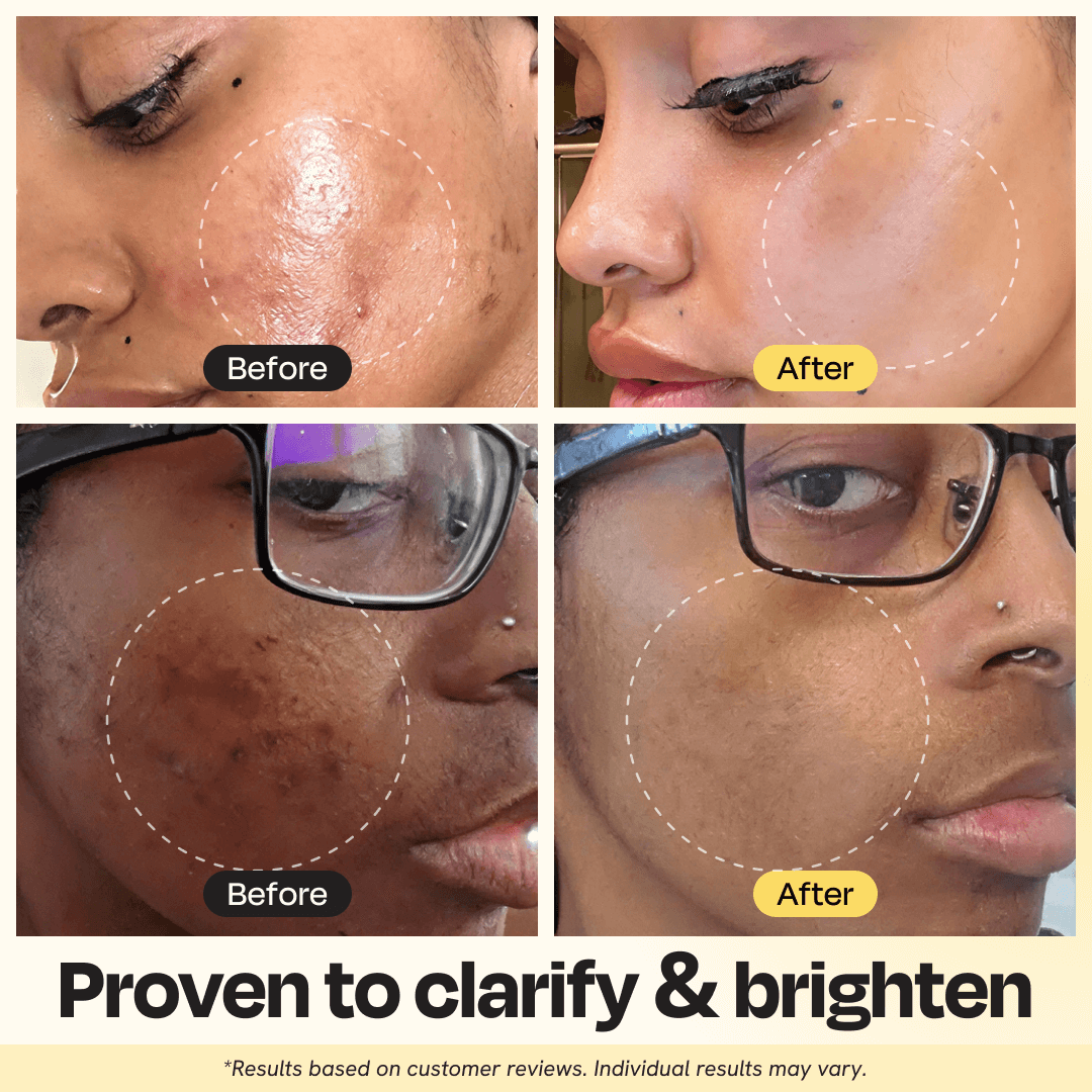 Gleamin Vitamin C Clay Mask