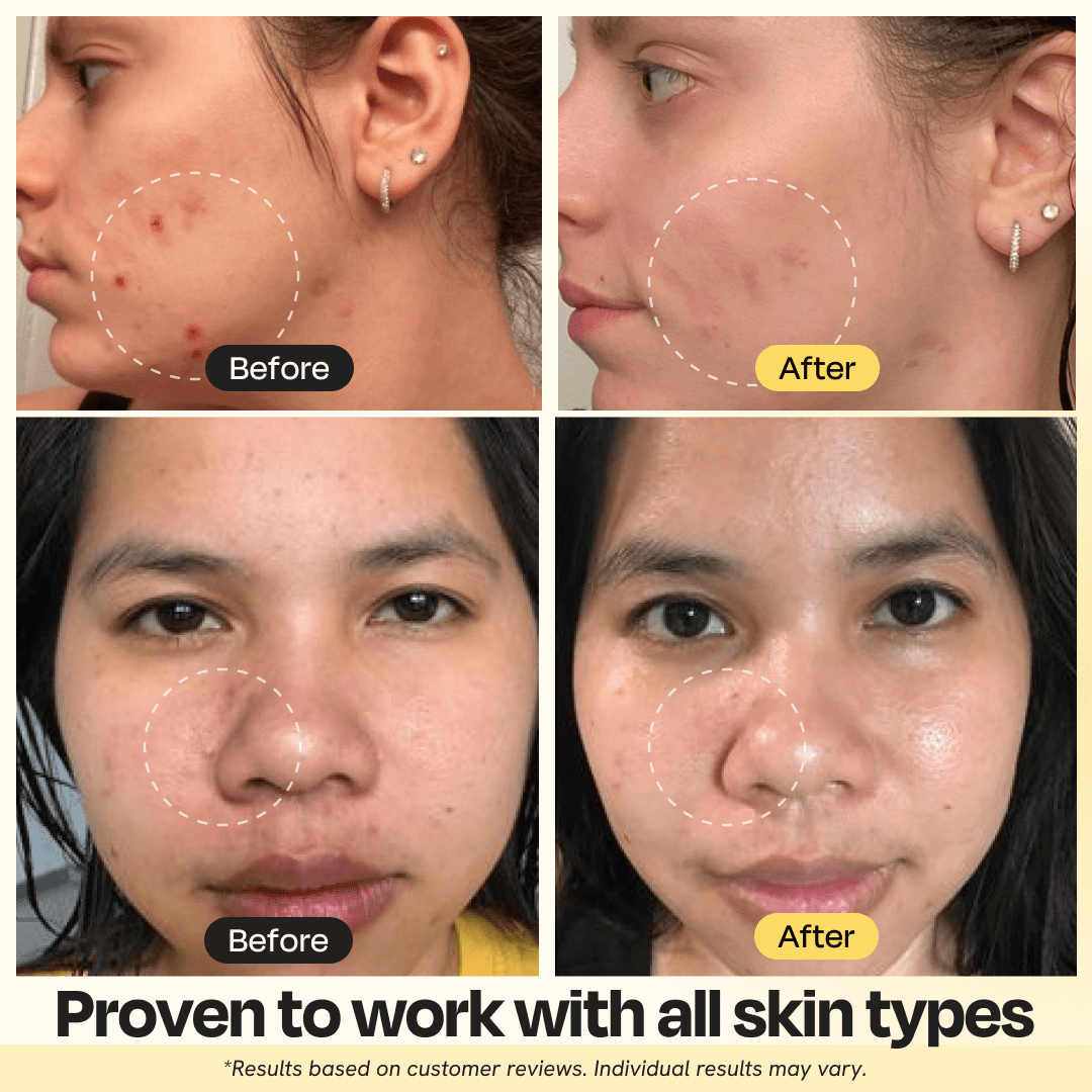Gleamin Vitamin C Clay Mask